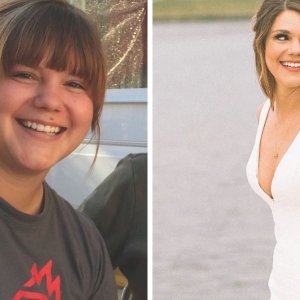 before and after weight loss